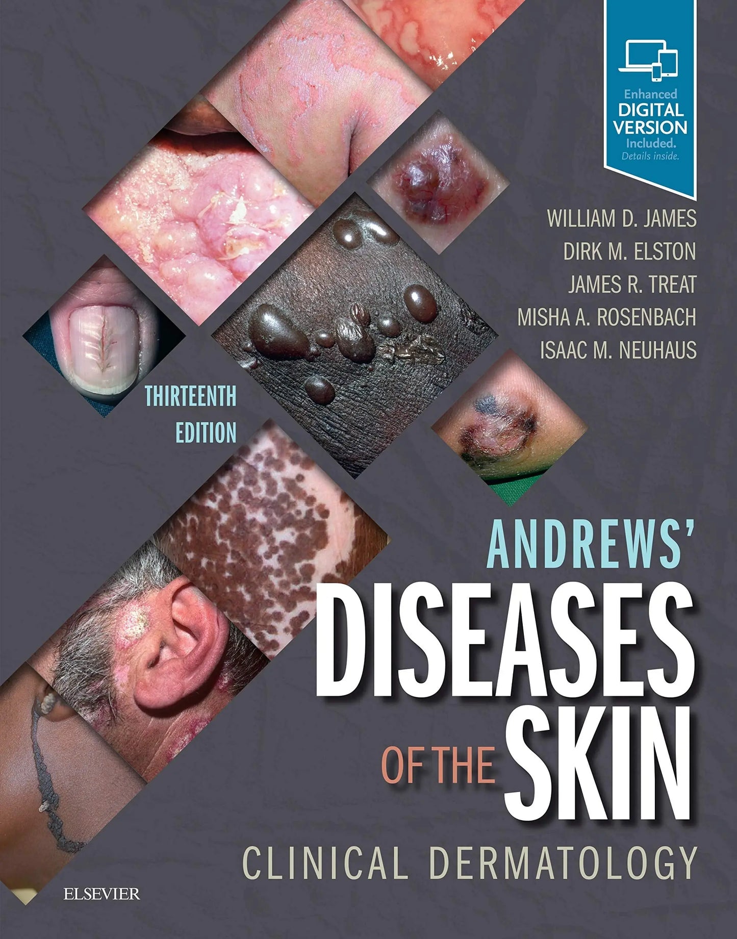 Andrews' Diseases of the Skin Clinical Dermatology by William D. James – book cover