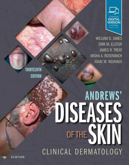 Andrews' Diseases of the Skin Clinical Dermatology by William D. James