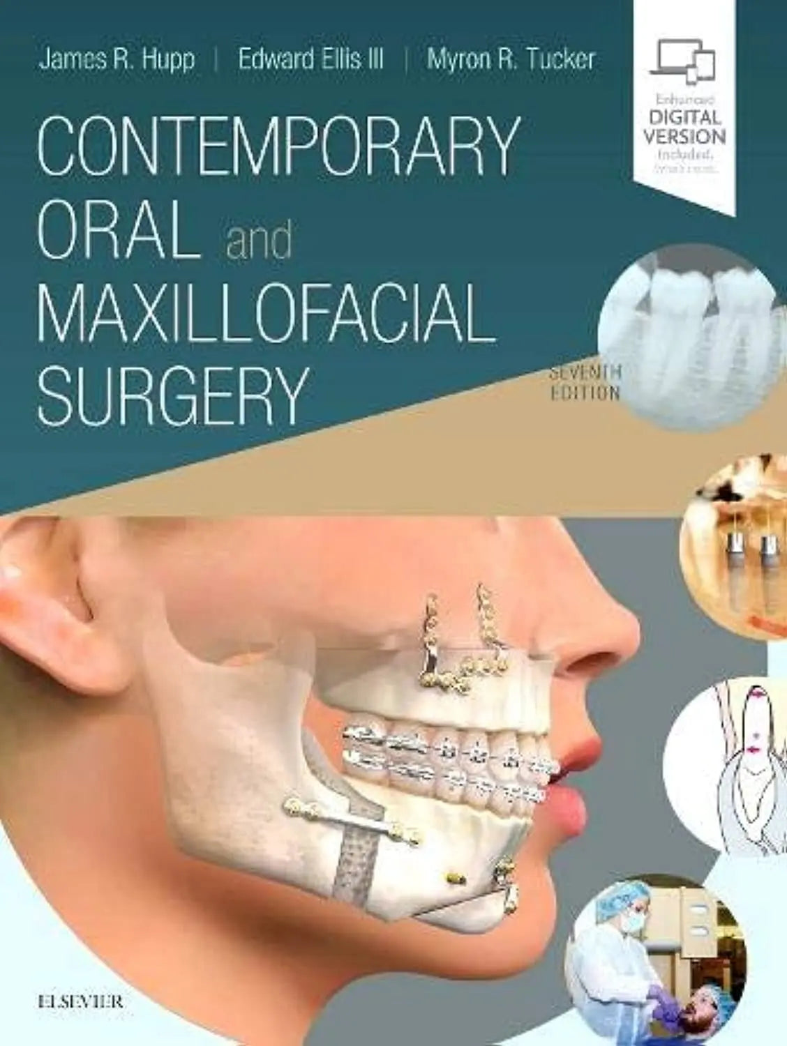 Contemporary Oral and Maxillofacial Surgery by James R. Hupp – book cover
