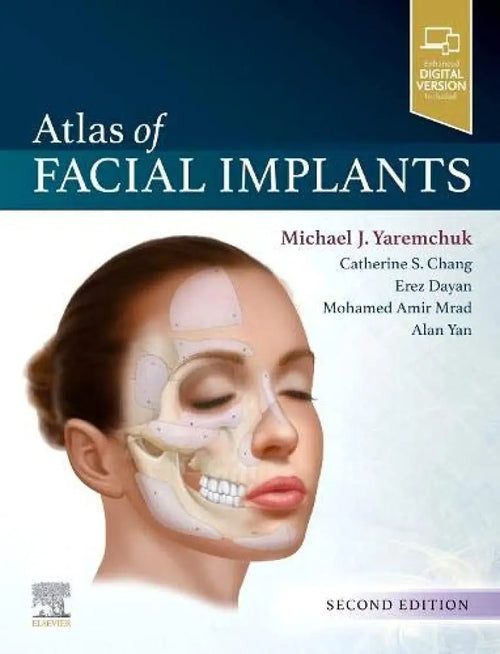 Atlas of Facial Implants by Michael J. Yaremchuk