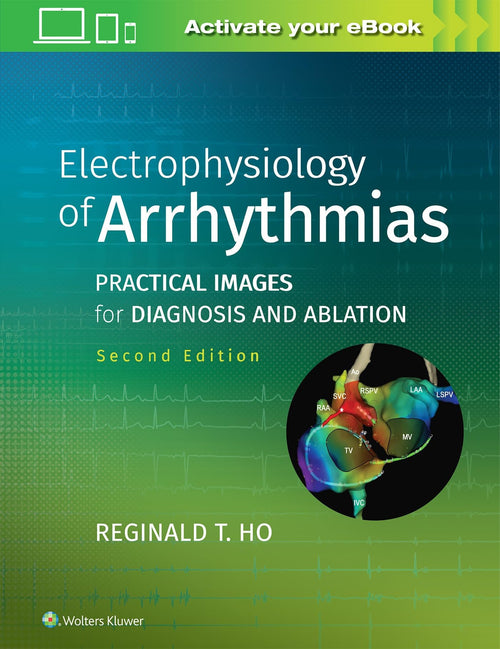 Electrophysiology of Arrhythmias Practical Images for Diagnosis and Ablation