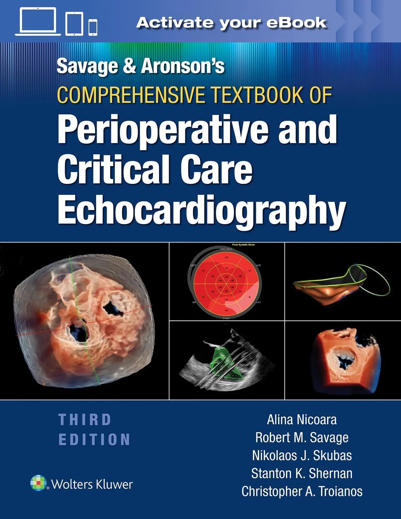 Savage & Aronson's Comprehensive Textbook of Perioperative and Critical Care Echocardiography by Robert M. – book cover