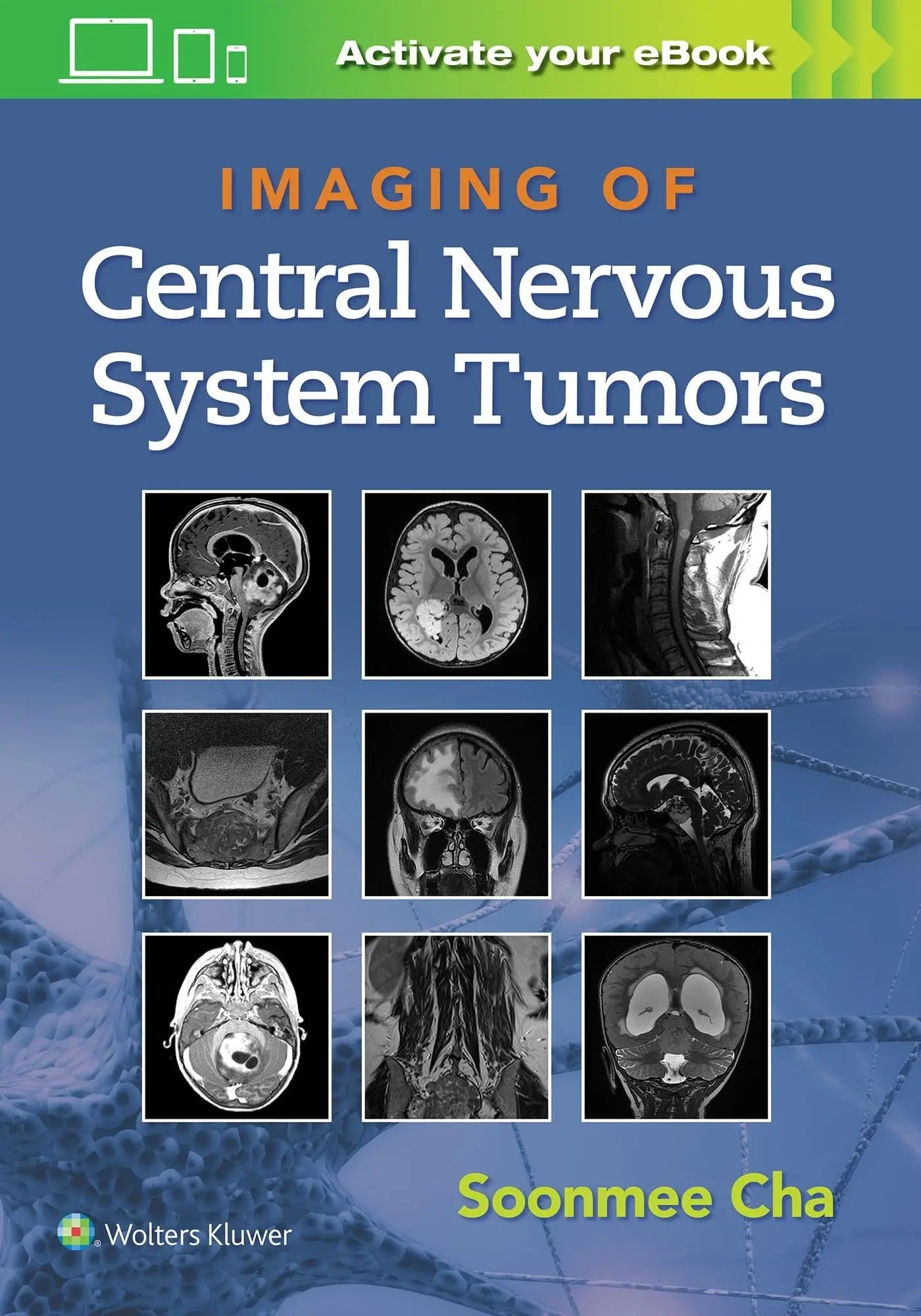 Imaging of Central Nervous System Tumors by Soonmee Cha – book cover