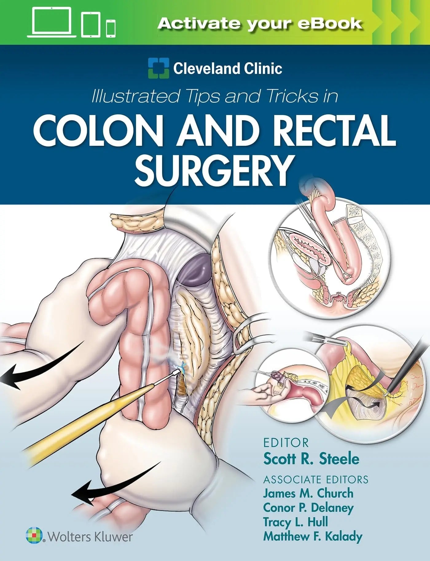 Cleveland Clinic Illustrated Tips and Tricks in Colon and Rectal Surgery by Scott Steele – book cover