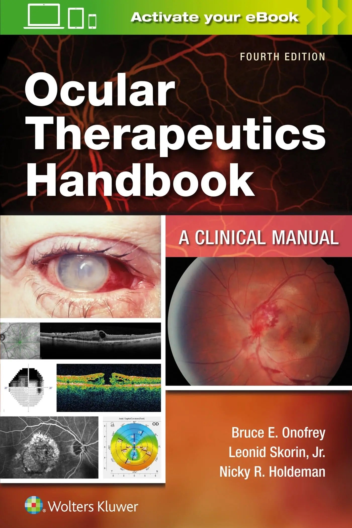 Ocular Therapeutics Handbook A Clinical Manual by Bruce E. Onofrey – book cover