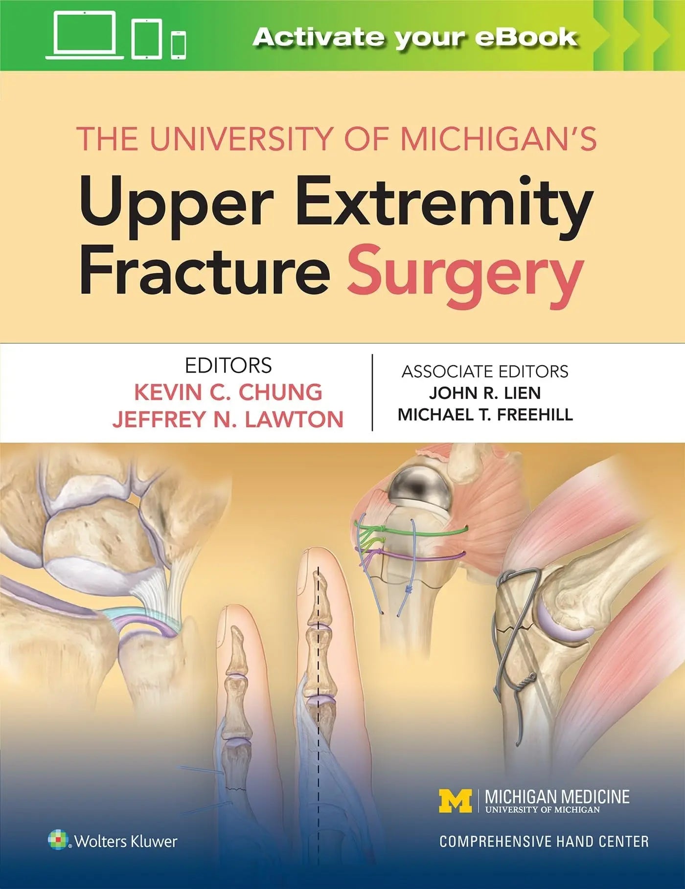 The University of Michigan's Upper Extremity Fracture Surgery by Kevin C. Chung – book cover