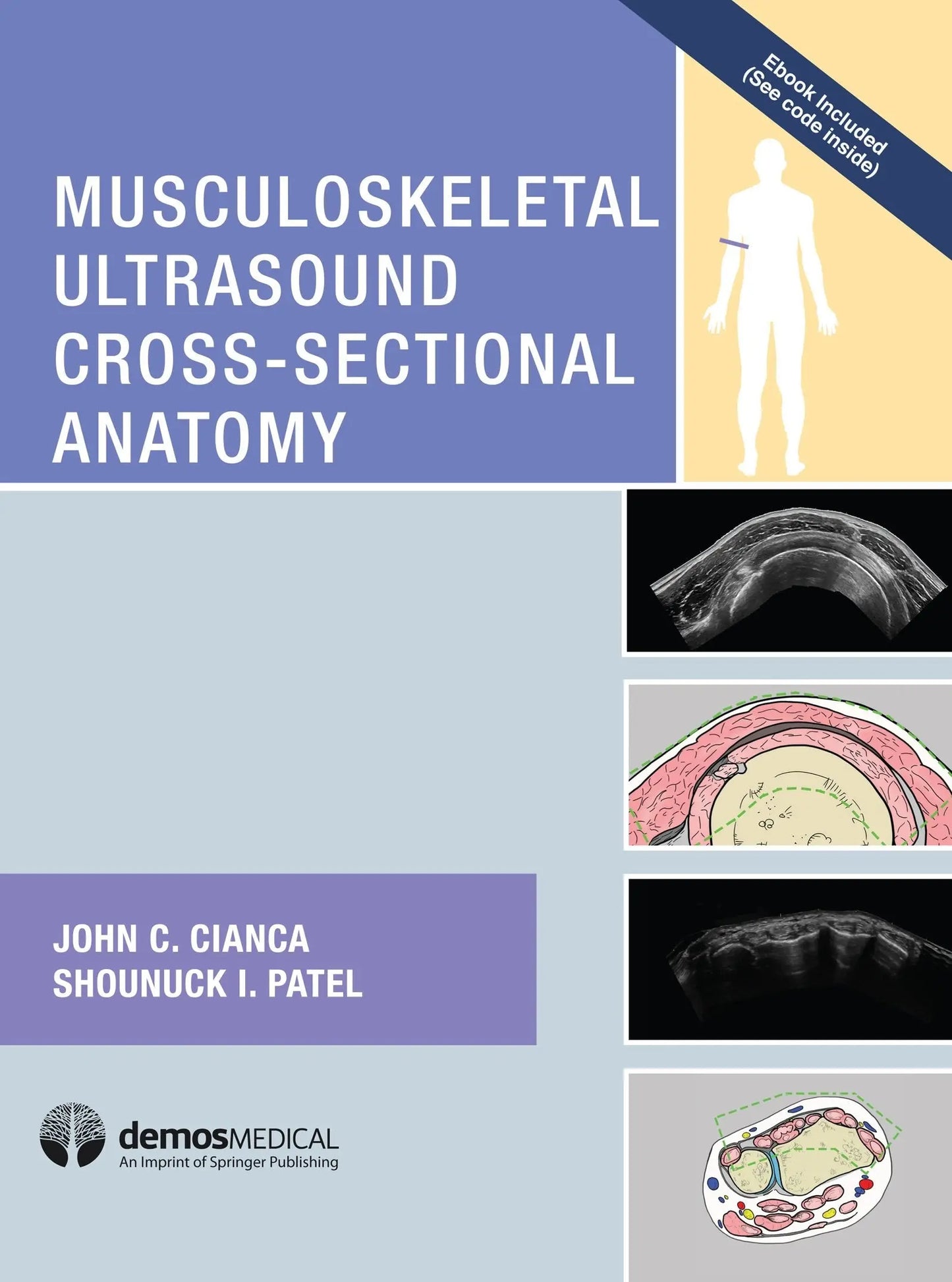 Musculoskeletal Ultrasound Cross Sectional Anatomy by John C. Cianca – book cover