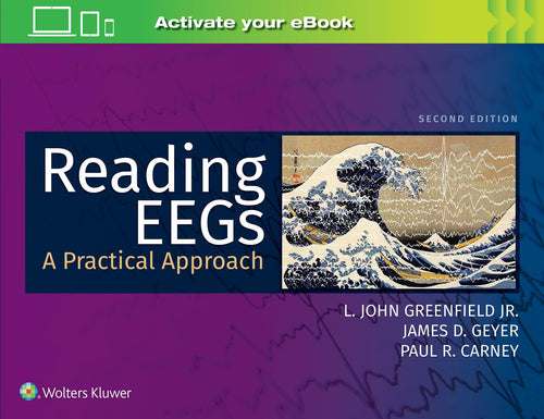 Reading EEGs A Practical Approach