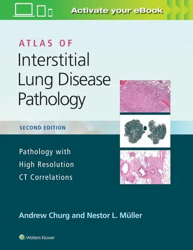 Atlas of Interstitial Lung Disease Pathology Lippincott Williams & Wilkins
