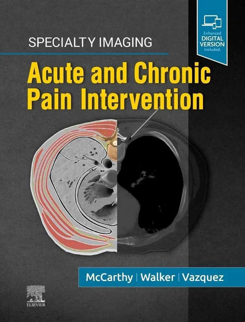Specialty Imaging: Acute and Chronic Pain Intervention by Colin J. McCarthy