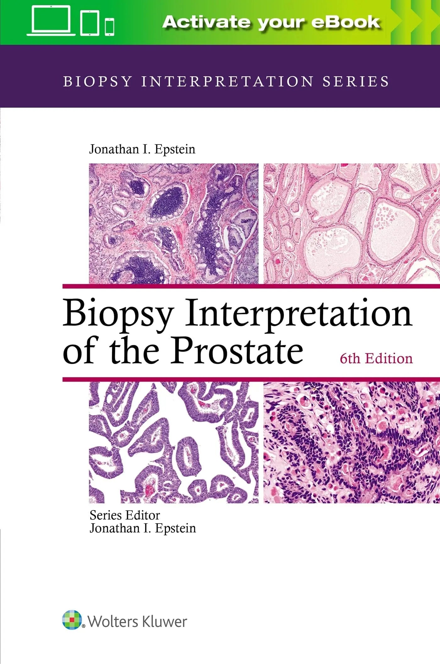 Biopsy Interpretation of the Prostate by Jonathan I. Epstein – book cover