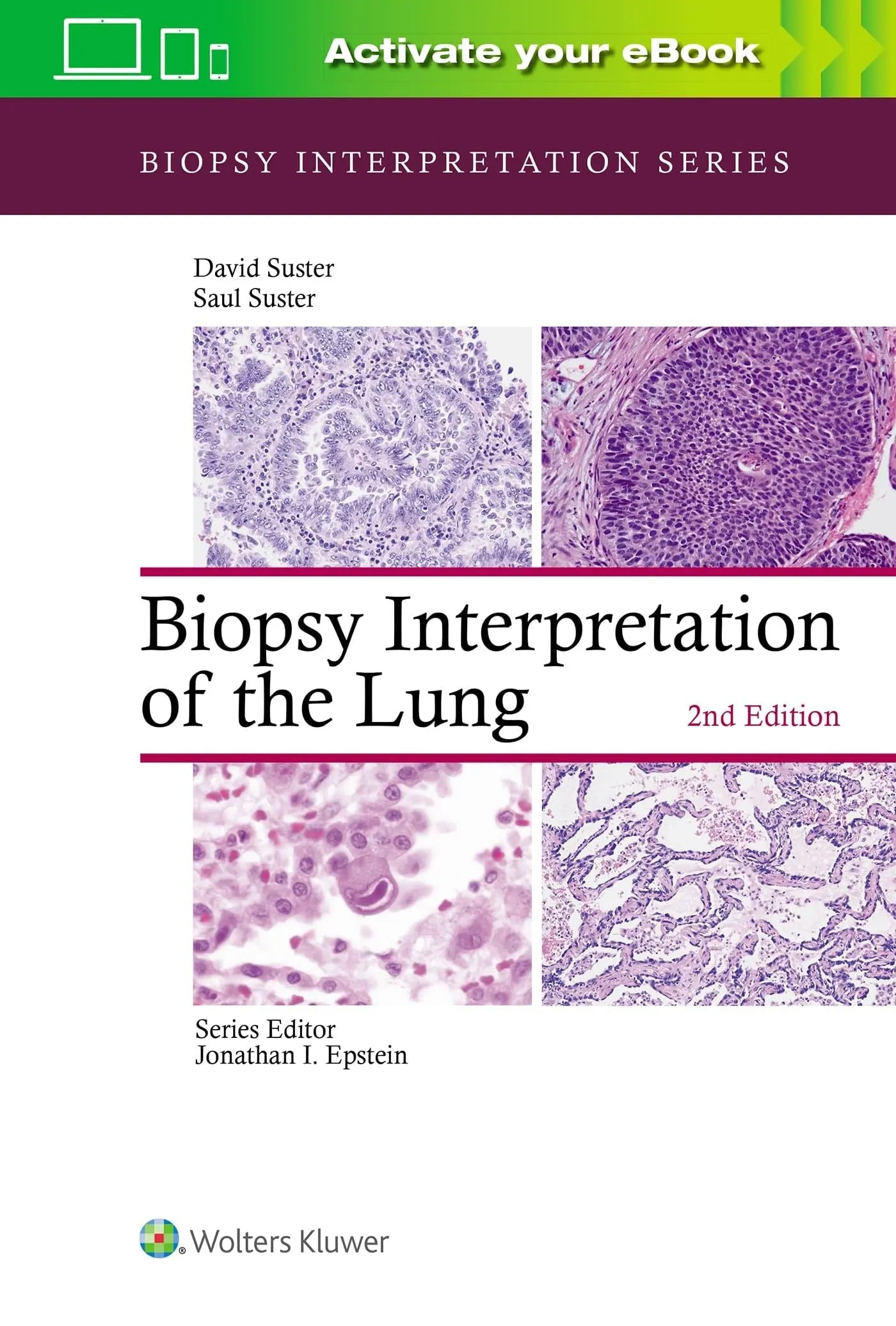 Biopsy Interpretation of the Lung by Saul Suster – book cover