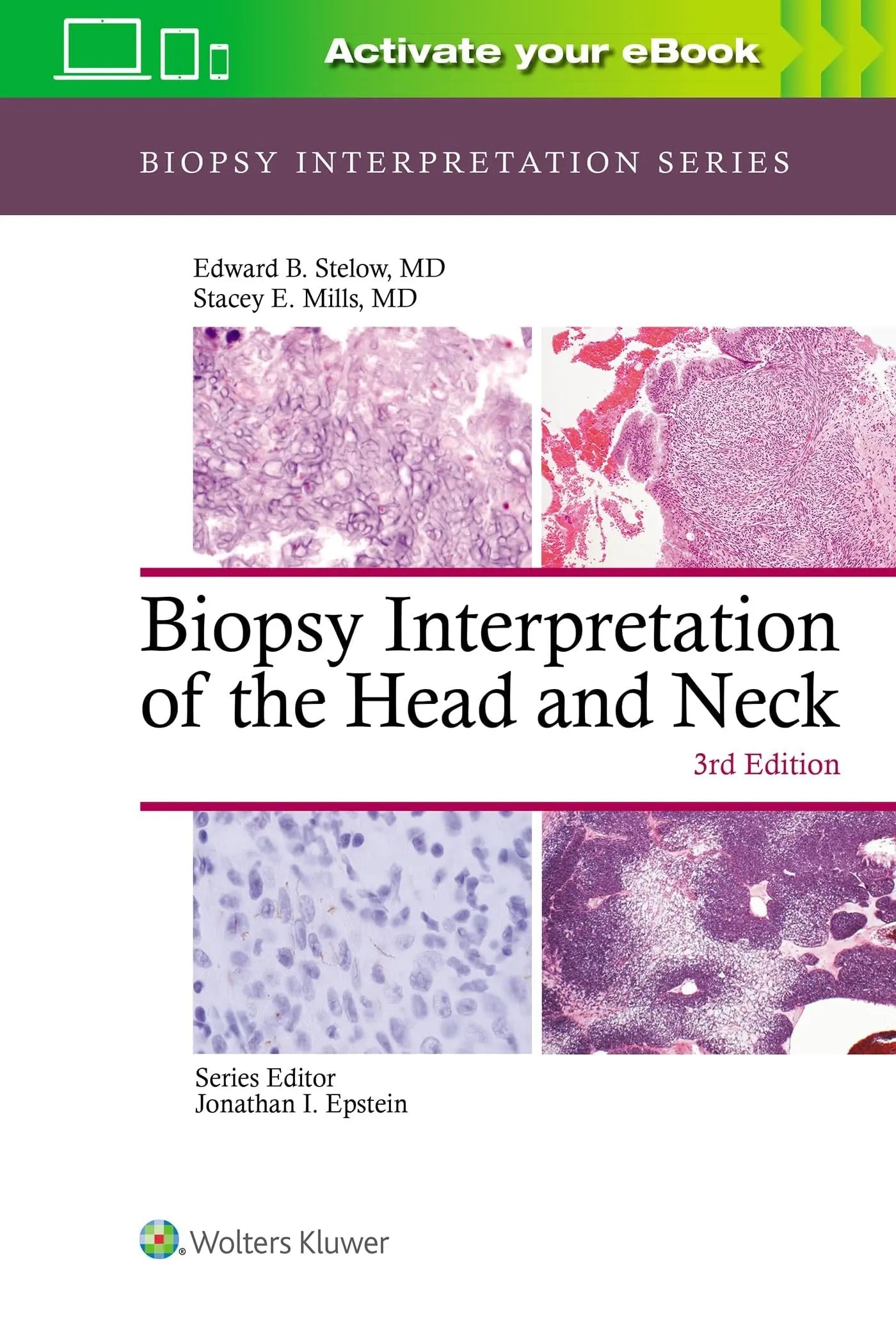 Biopsy Interpretation of the Head and Neck by Edward B. Stelow – book cover