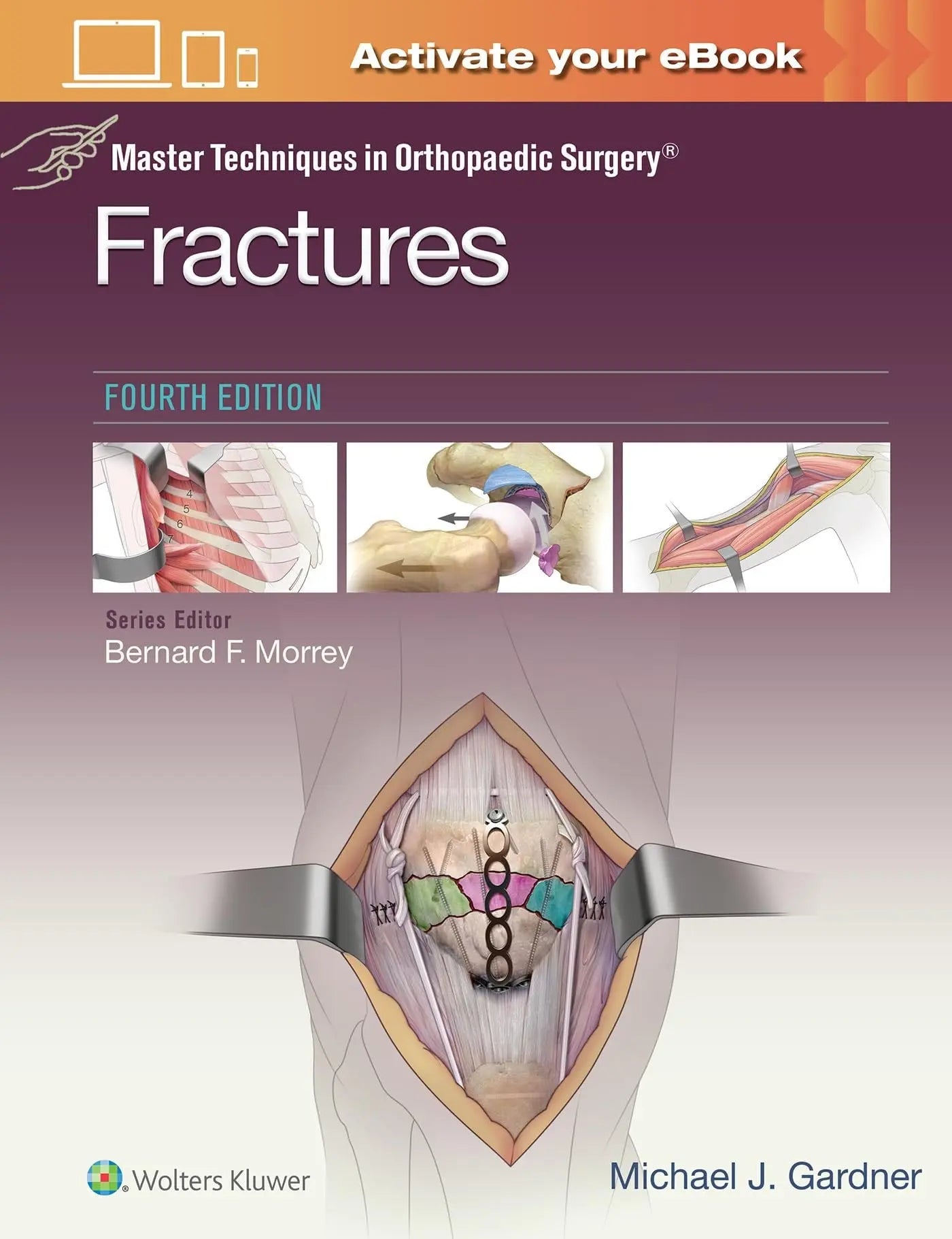 Master Techniques in Orthopaedic Surgery: Fractures by Michael J. Gardner – book cover