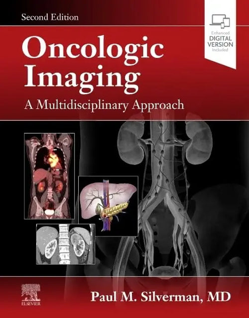 Oncologic Imaging A Multidisciplinary Approach by Paul M. Silverman