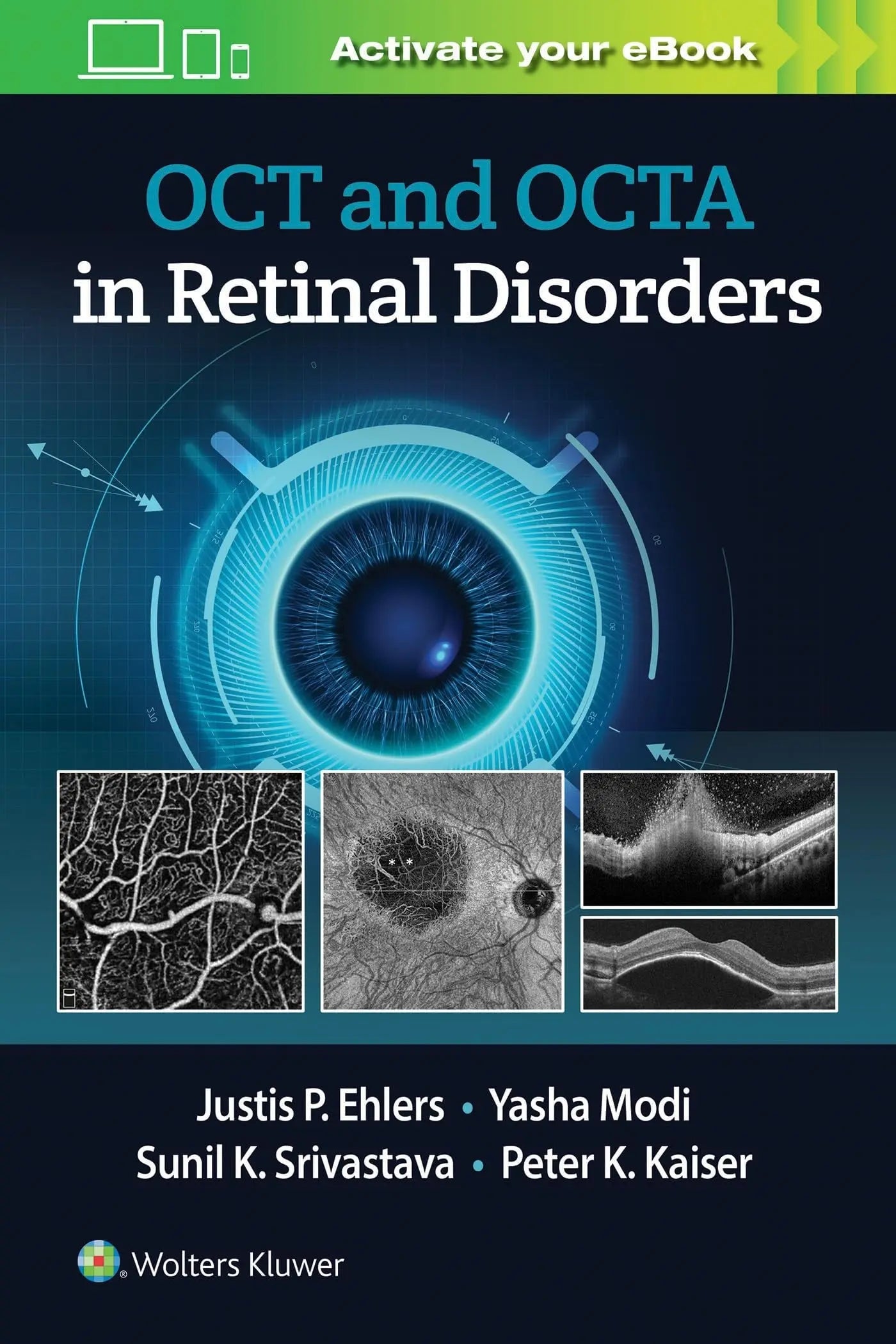 OCT and OCTA in Retinal Disorders by Justis P. Ehlers – book cover