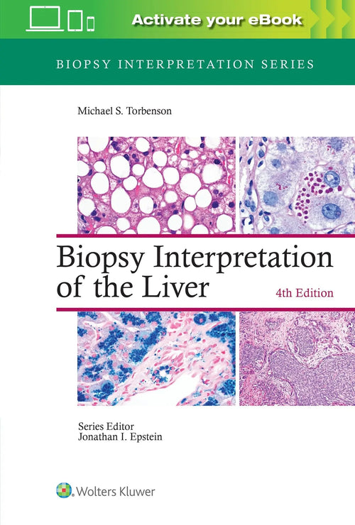 Biopsy Interpretation of the Liver by Michael Torbenson