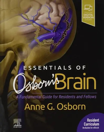 Essentials of Osborn's Brain A Fundamental Guide for Residents and Fellows Elsevier