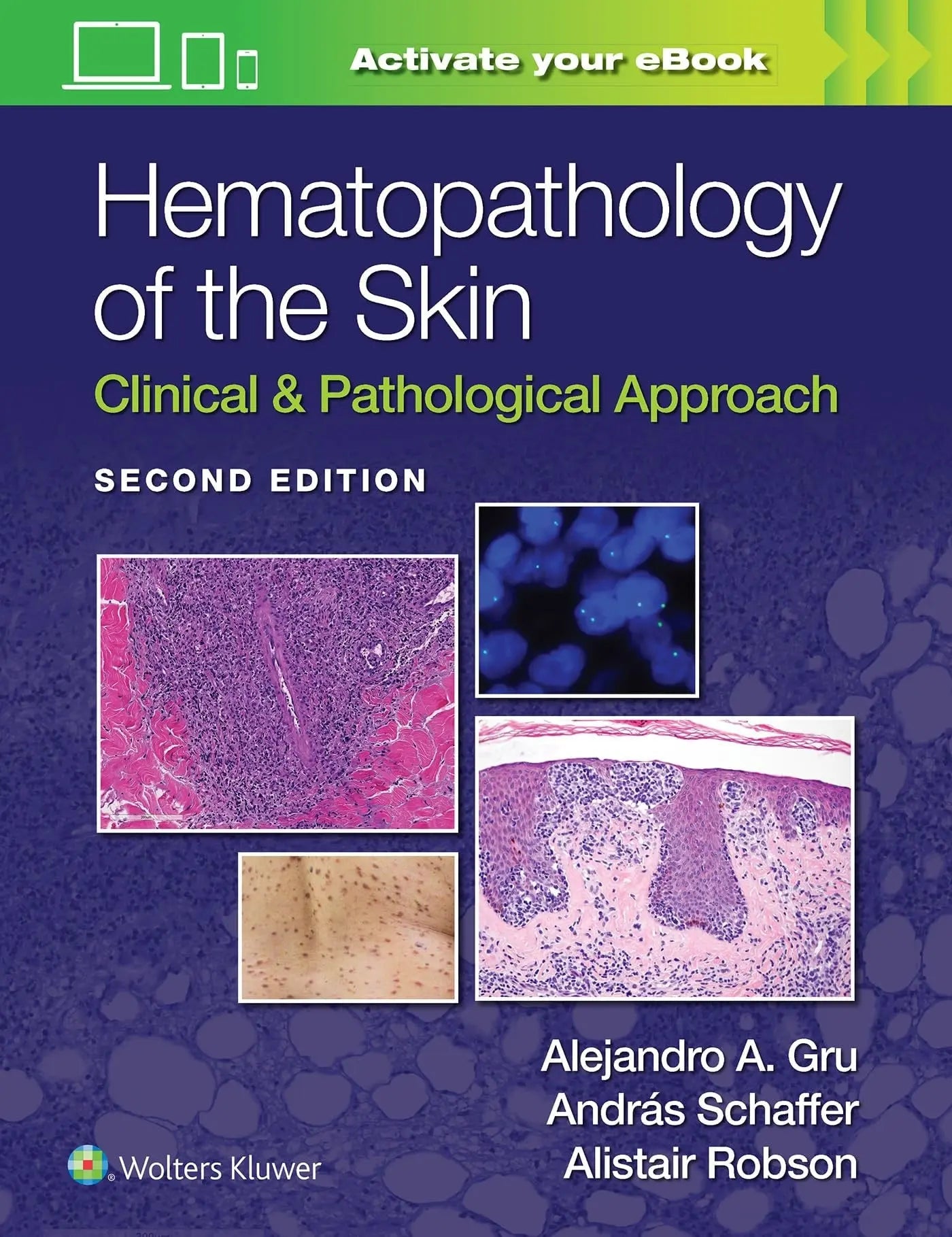Hematopathology of the Skin Clinical & Pathological Approach by Alejandro Ariel Gru – book cover