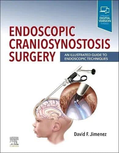 Endoscopic Craniosynostosis Surgery An Illustrated Guide to Endoscopic Techniques by David F. Jimenez – book cover