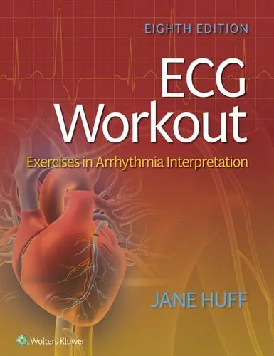 ECG Workout Exercises in Arrhythmia Interpretation Wolters Kluwer