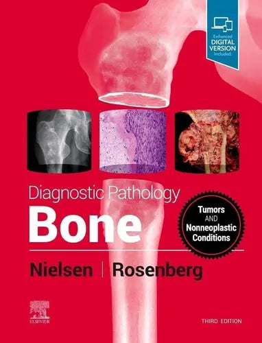 Diagnostic Pathology: Bone Elsevier