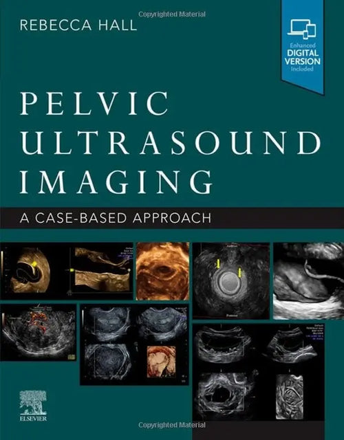 Pelvic Ultrasound Imaging A Cased-Based Approach by Rebecca Hall