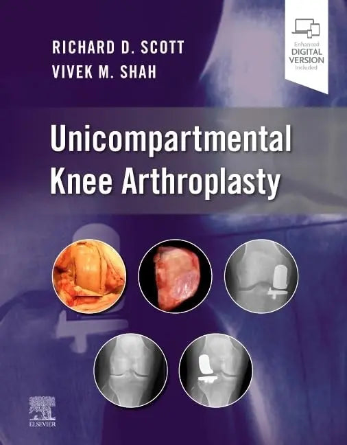 Unicompartmental Knee Arthroplasty by Richard D. Scott Elsevier