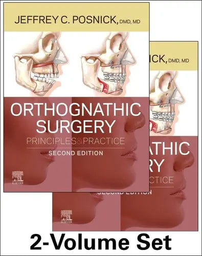 Orthognathic Surgery - 2 Volume Set Principles and Practice