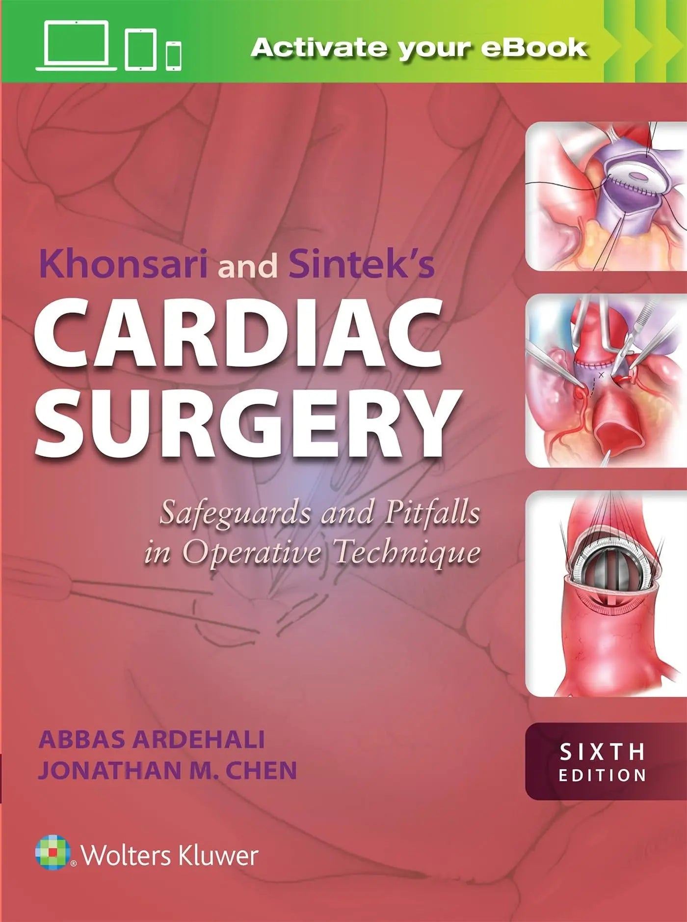 Khonsari and Sintek's Cardiac Surgery Safeguards and Pitfalls in Operative Technique by Abbas ARDEHALI – book cover