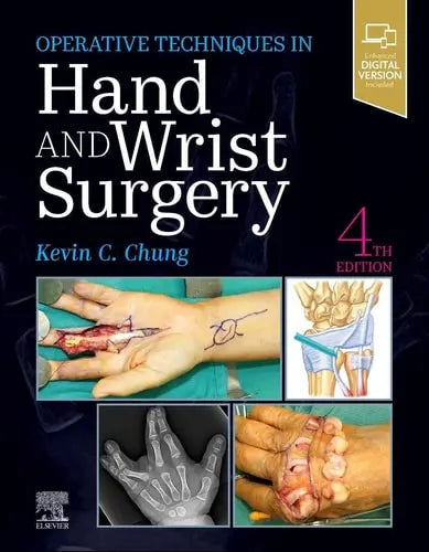 Operative Techniques: Hand and Wrist Surgery Elsevier
