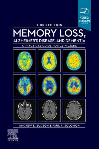 Memory Loss, Alzheimer's Disease and Dementia A Practical Guide for Clinicians Elsevier