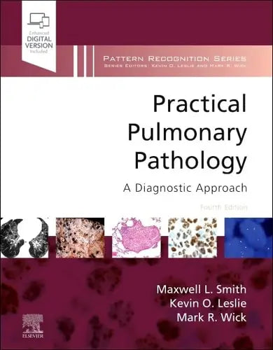 Practical Pulmonary Pathology A Diagnostic Approach