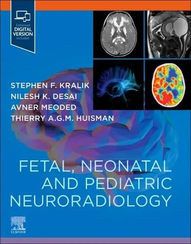 Fetal, Neonatal and Pediatric Neuroradiology Elsevier