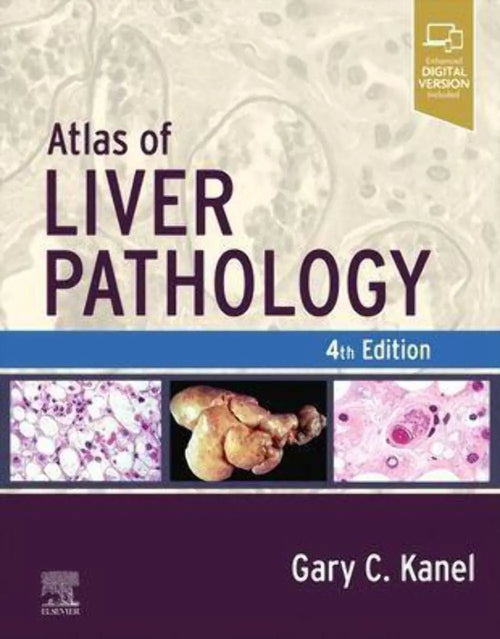 Atlas of Liver Pathology by Gary C. Kanel