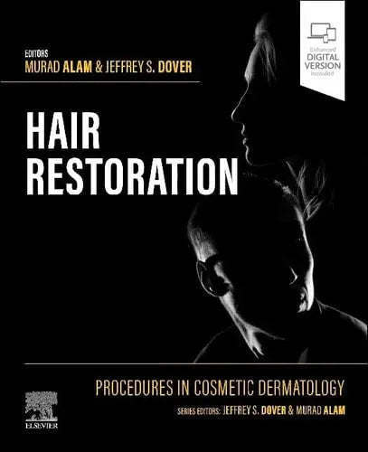 Procedures in Cosmetic Dermatology: Hair Restoration Elsevier