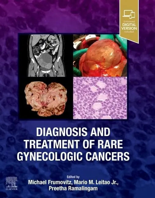 Diagnosis and Treatment of Rare Gynecologic Cancers by Mario M. Leitao Jr. – book cover