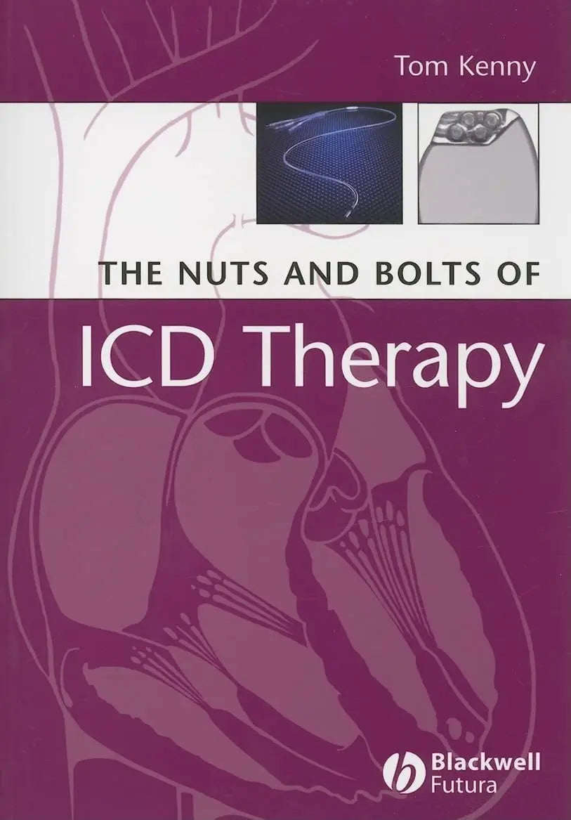 The Nuts and Bolts of ICD Therapy by Tom Kenny – book cover