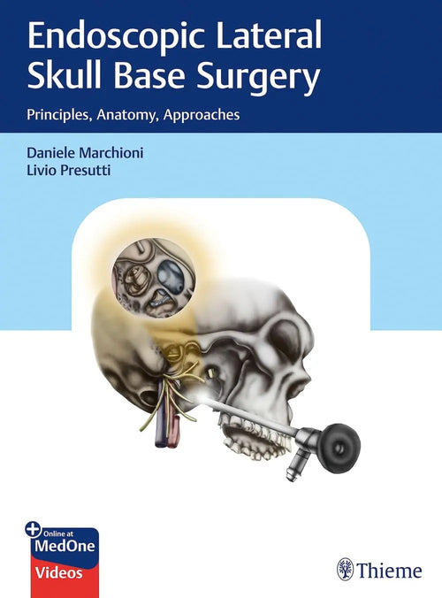 Endoscopic Lateral Skull Base Surgery Principles, Anatomy, Approaches by Livio Presutti
