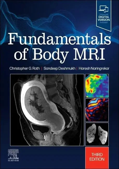 Fundamentals of Body MRI by Christopher G. Roth – book cover