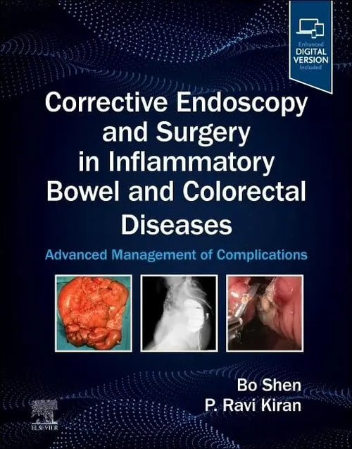 Corrective Endoscopy and Surgery in Inflammatory Bowel and Colorectal Diseases Advanced Management of Complications by Bo Shen