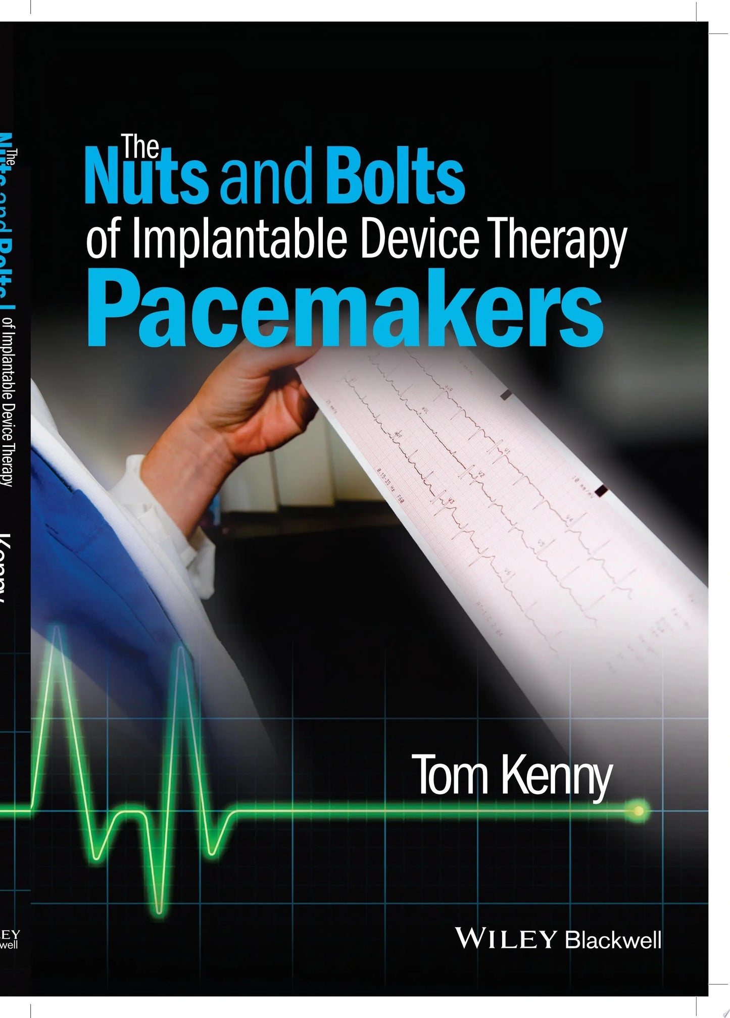 The Nuts and Bolts of Implantable Device Therapy Pacemakers by Tom Kenny – book cover