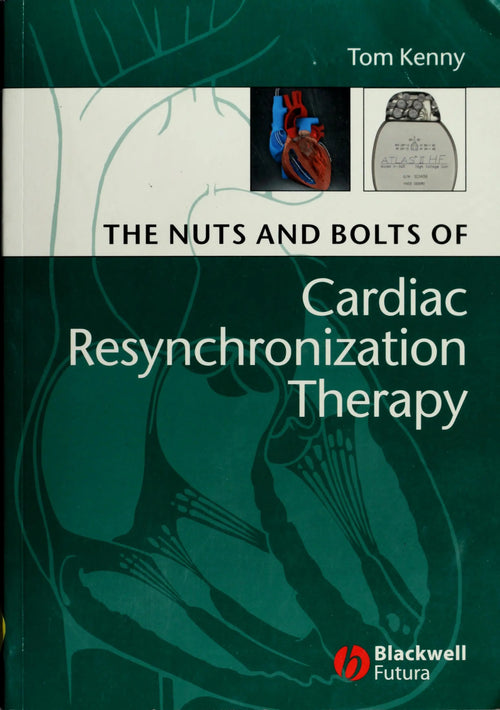 The Nuts and Bolts of Cardiac Resynchronization Therapy by Tom Kenny