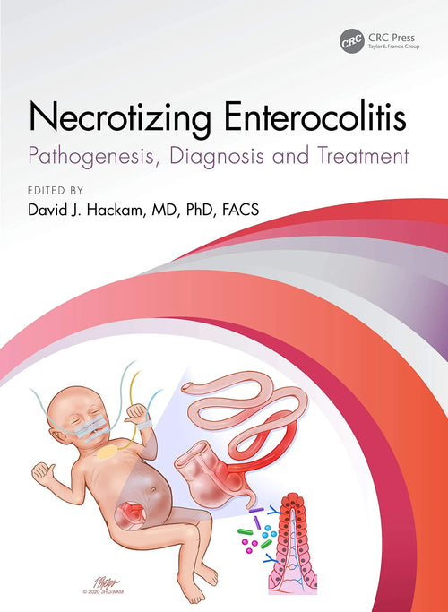 Necrotizing Enterocolitis Pathogenesis, Diagnosis and Treatment by David J. Hackam