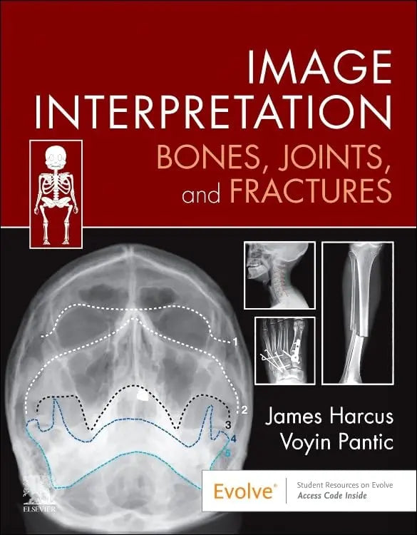 Image Interpretation: Bones, Joints, and Fractures by James Harcus – book cover