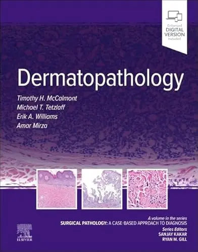 Dermatopathology Surgical Pathology: a Case-Based Approach to Diagnosis by Tim McCalmont – book cover