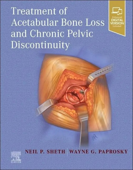 Treatment of Acetabular Bone Loss and Chronic Pelvic Discontinuity by Neil P. Sheth – book cover