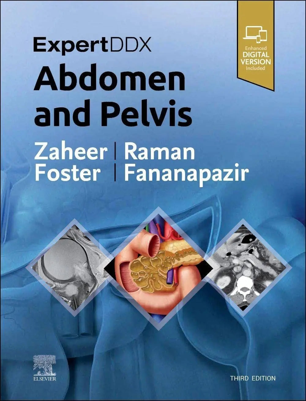 ExpertDDx: Abdomen and Pelvis by Atif Zaheer – book cover