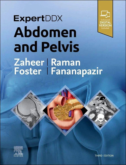 ExpertDDx: Abdomen and Pelvis by Atif Zaheer