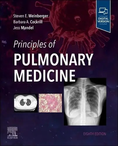 Principles of Pulmonary Medicine Elsevier